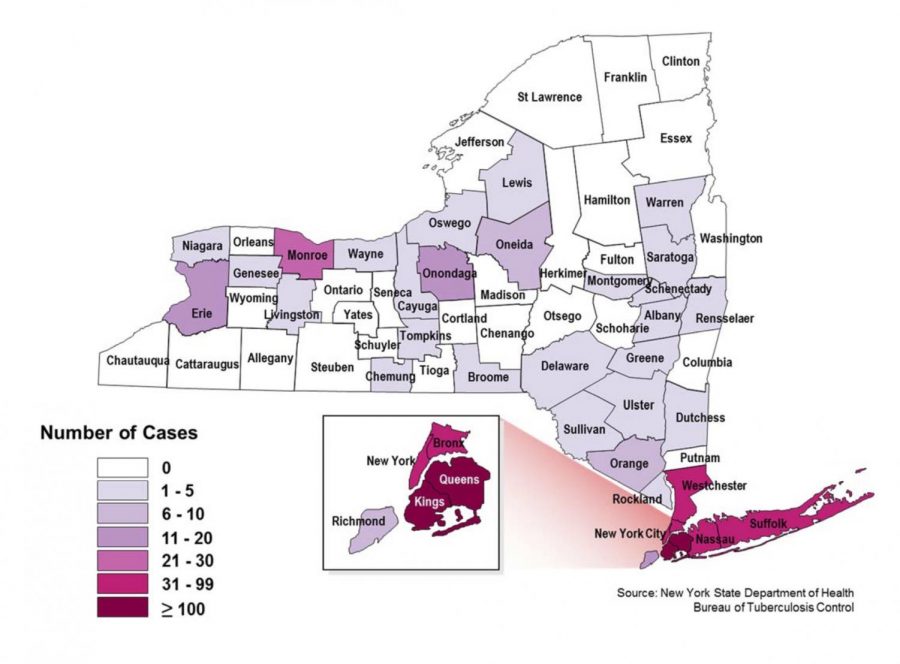From the 2016 New York State Department of Health report on TB in New York State